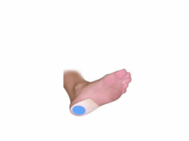 TALONETTE EN SILICONE TS